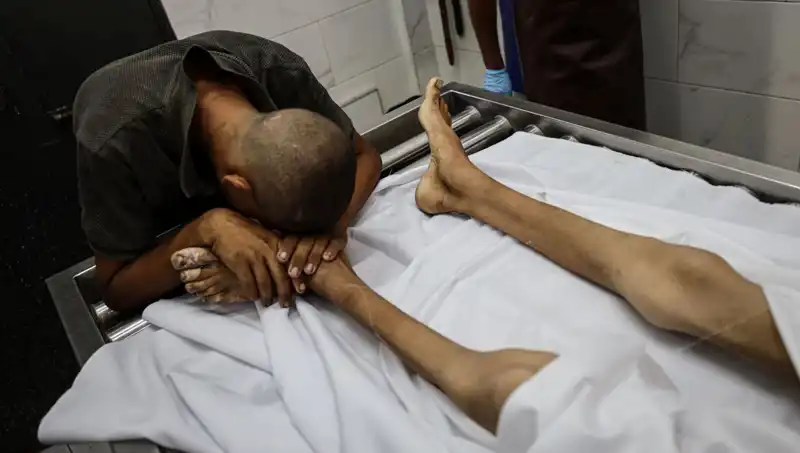 Gazze'de Açlık Krizi Büyüyor: Bir Çocuk Daha Hayatını Kaybetti