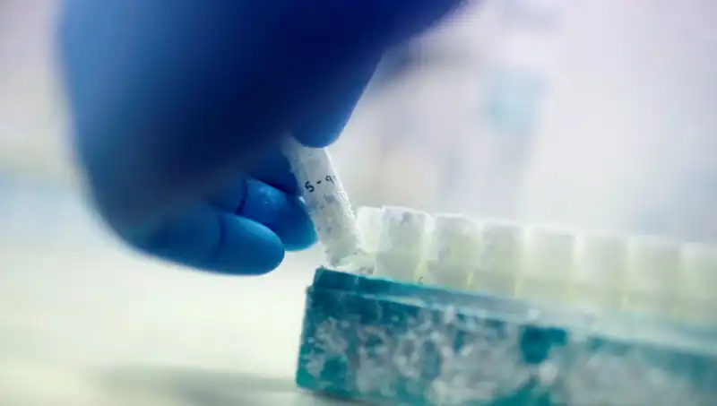 Tıbbi Skandal: 85 Sperm Donörü, Binlerce Çocuğa Baba Olmuş!