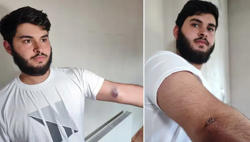 Bahçeye Kaçan Top Mahallede Kaos Yarattı: "Conolar Kamyonetle Geldi"