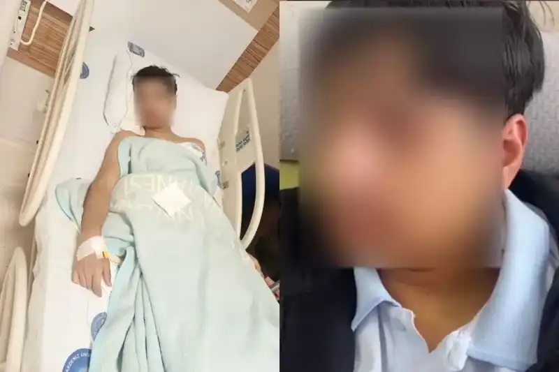 Antalya'da Şok Eden Akran Zorbalığı Olayı: Arkadaşının Çenesini Kırdı